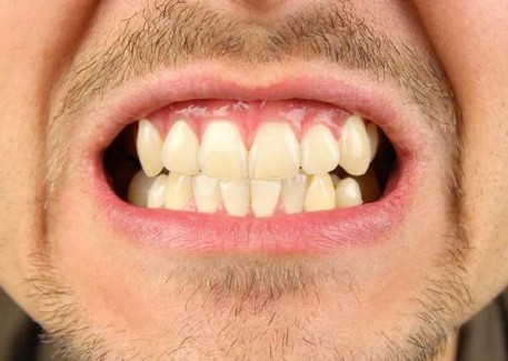 Diş Sıkması Nedenleri