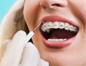 Ortodonti (Diş Düzeltme)